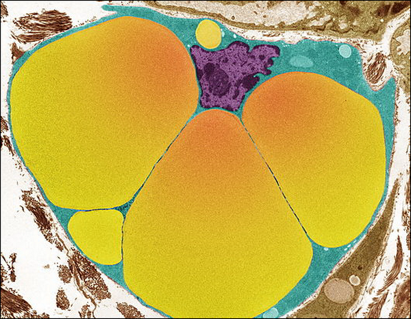 Жировая клетка с каплями жира внутри (фото Steve Gschmeissner)